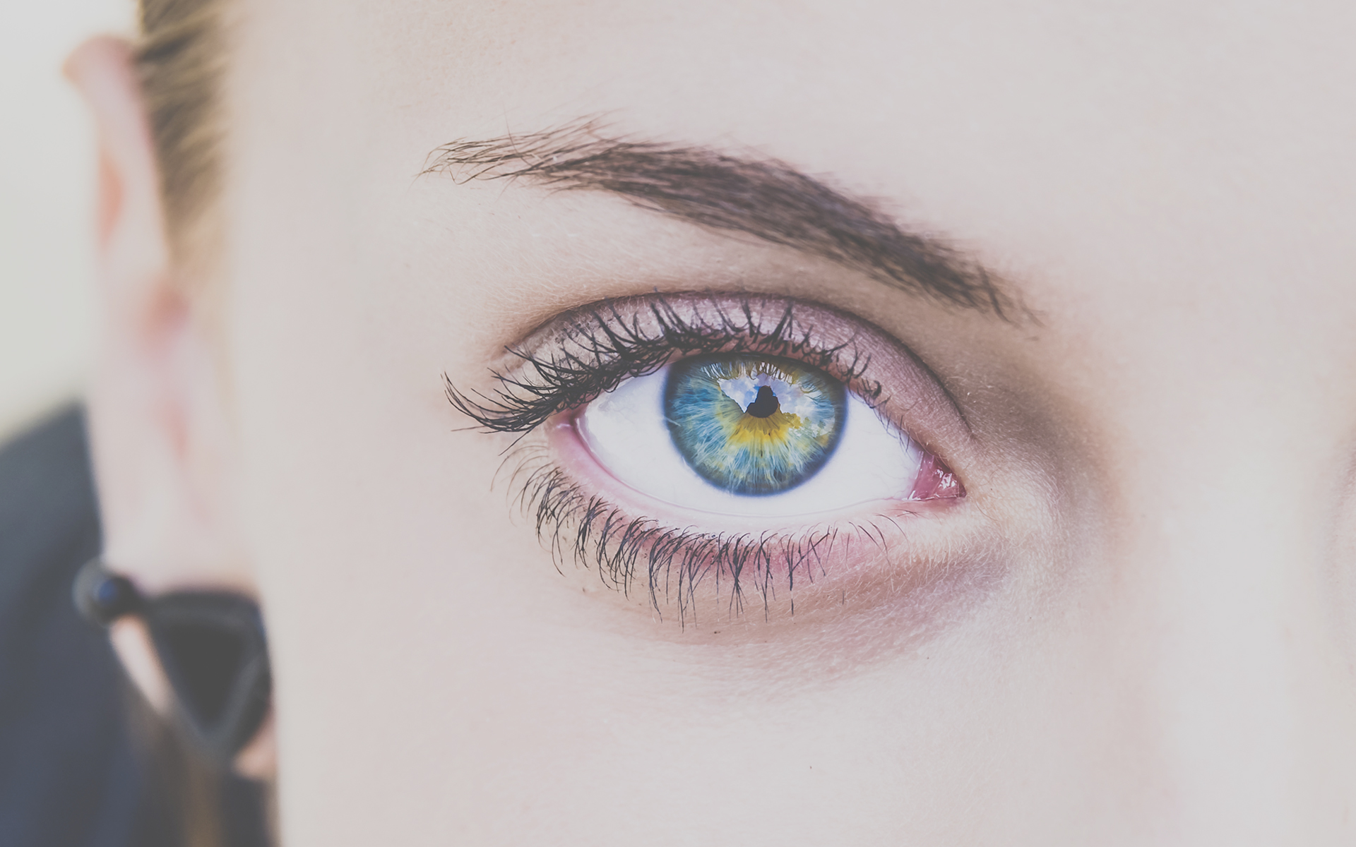 Avoid Accutane and Roaccutane – It can lead to eye infections